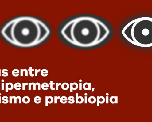 miopia-hipermetropia-astigmatismo-presbiopia
